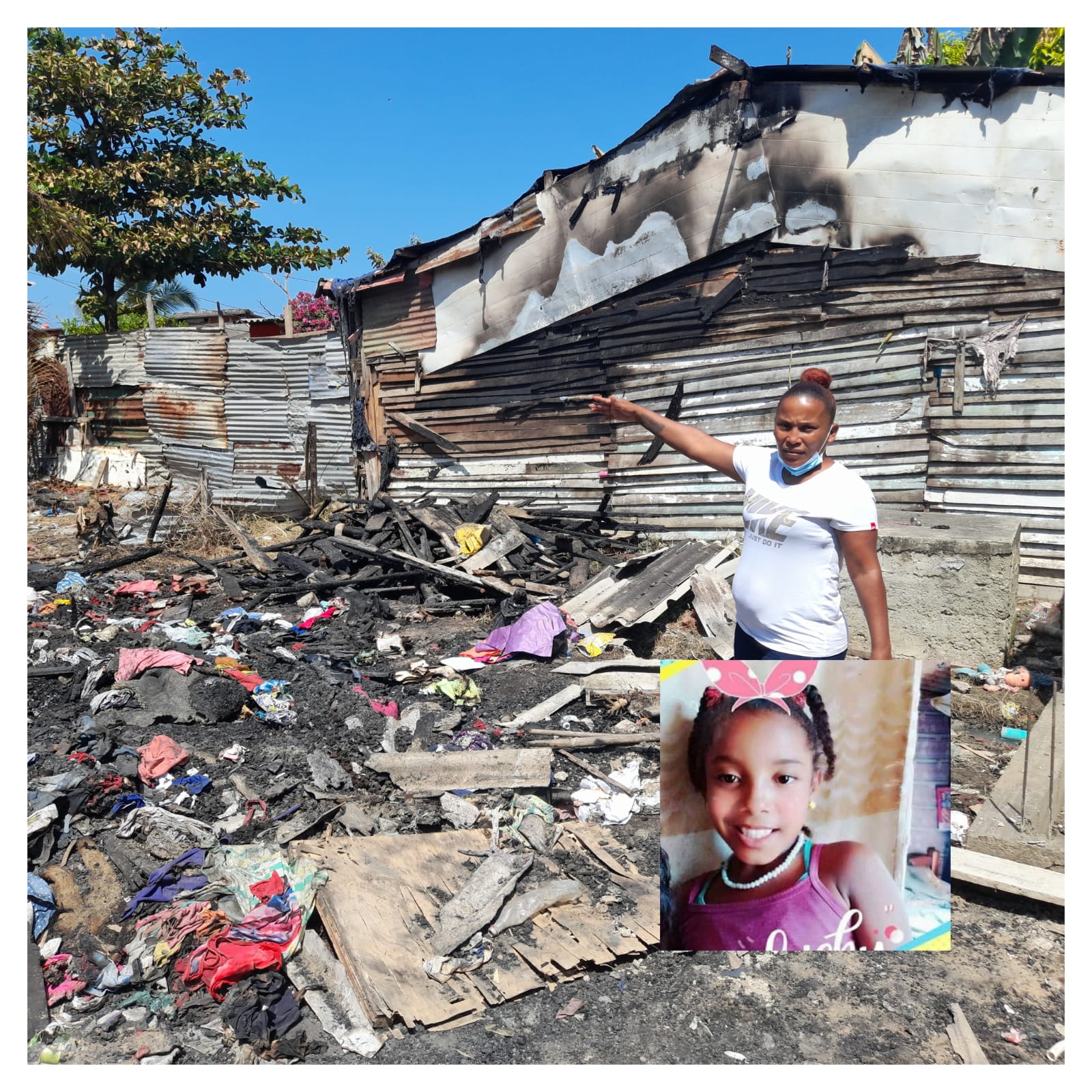 En grave estado niña quemada en incendio de su vivienda en Olaya