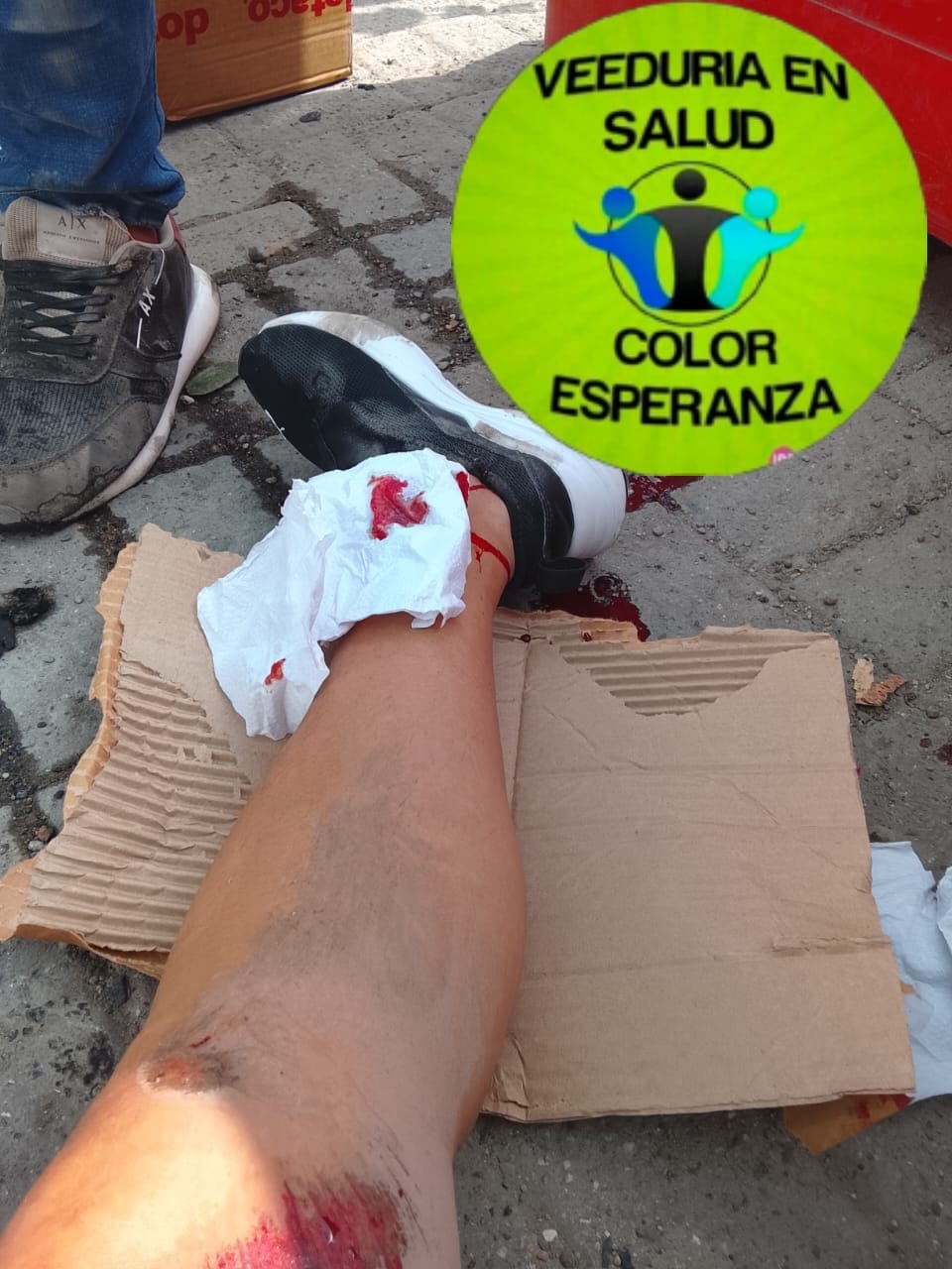 Veeduría en Salud Color Esperanza rechaza abandono de víctima en accidente de tránsito en Mamonal
